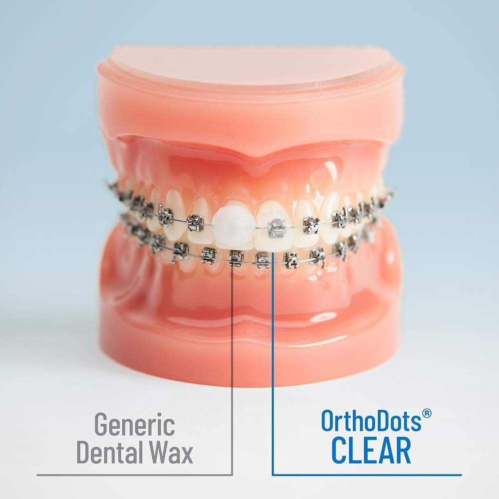 OrthoDots CLEAR – 24-Hour Protection | Sticks Better than Dental Wax | Moisture Activated Braces Wax Alternative for Pain Caused by Braces, Clear Aligner Trays, and Other Orthodontic Appliances