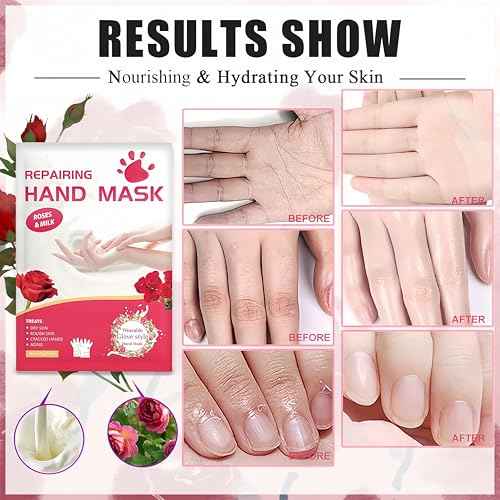 Roses & Milk Hand Repair Gloves, 5 Pairs Hydrating Hand Masks for Dry Cracked Hands, Moisturizing & Softening Gloves for Women & Men, Nourishing Hand Spa Treatment