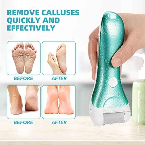 Callus Remover for Feet, Nicebirdie Electric Foot File Callus Removers Rechargeable Waterproof Pedicure Tools Foot Scrubber Shaver Feet Care Tool for Cracked Heels Dead Skin £¨Green£©