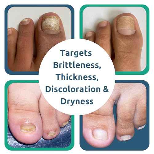 Dr. Blaine's Tineacide Nail Renewal Gel ? For Thick, Brittle & Discolored Nails ? Softens, Hydrates & Improves Appearance ? Targets Cracking & Yellowing ? Precision Clippers ? 1.25 fl oz