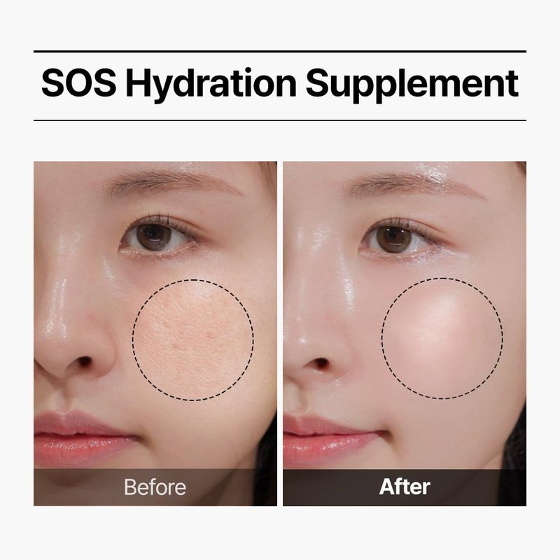WELLAGE Real Hyaluronic Acid Serum Kit - 7 Ampoules for Firming & Moisturizing | Korean Beauty Essentials