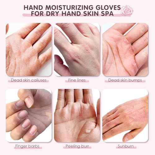 AUSLKA Hand Mask Moisturizing Glove 6 Pairs, Hand Care Moisturizing Gloves with Shea Butter, Hydrating Hand Masks, Hand Peeling Mask for Dry& Dead Skin, Men Women (Rose)