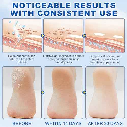 60% Urea Cream Stick plus 2% Salicylic Acid, Maximum Strength Urea Foot Cream Callus Remover for Dry Cracked Heels, Hands, Knees,Exfoliating Moisturizer, Dead Skin Remover Foot Balm 1.4oz (1pcs)