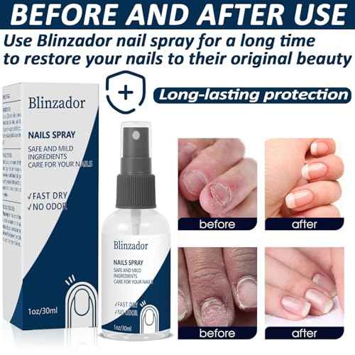 Toenail Treatment Extra Strength - Best Toenail Treatment Spray | Nail Treatment for Weak and Damaged Nails - Natural Plant Ingredients, Fast-Drying, Easy-To-Use | 1oz (30ml)