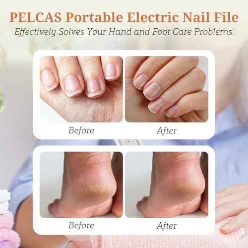 PELCAS Electric Toenail Grinder for Thick Toenails, 5 Speeds Manicure and Pedicure Kit, Cordless Nail Drill with LED Light, Electric Nail File for Human, Pet, Thick Toenails, Natural & Acrylic Nails