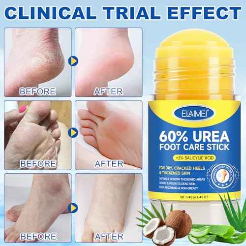 60% Urea Foot Cream for Cracked Heels, Maximum Strength 2% Salicylic Acid, Fast Absorbing, Intensive Moisturizing Foot Repair for Dry, Rough Skin & Callus Remover for Feet, 1.41 Oz