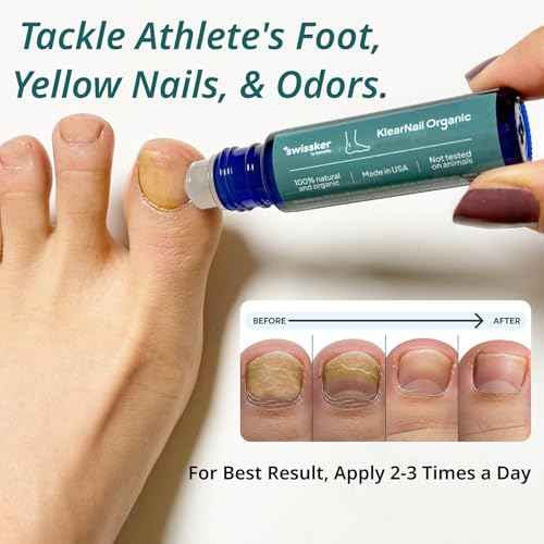 Swissklip KlearNail Toenail Stick | Medi-Care Treatment | Natural Solution for Healthy Nails I Suitable For Foot, Toe, and Fingernail I For Brittle Toenails ? 10ml / 0.3 Fl. Oz. Pack 1 - Made in USA