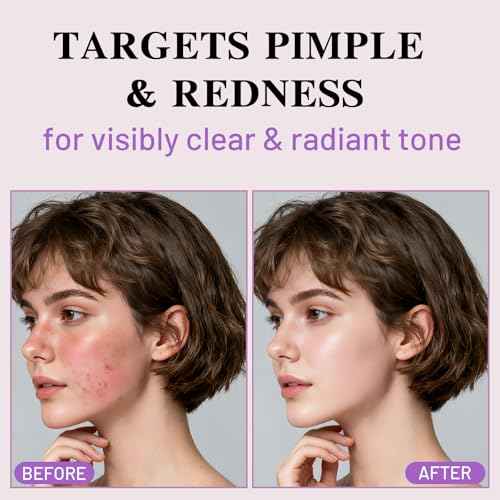 Collagen Face Mask Overnight, Acne Face Masks Sheet for Deep Hydrating and Glass Skin Glow, Jelly Gel Facial Mask for Women with Centella and Niacinamide, Oily Skin, 37gx4ea