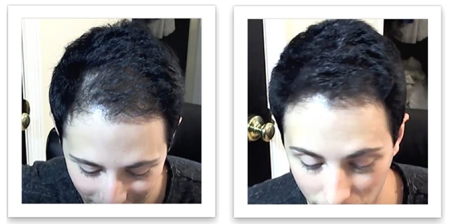 Caboki Hair Fibers - Natural Plant-Based Thinning Hair Solution for Men & Women | 10-Day Trial Size, Black