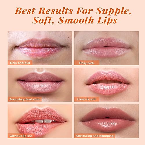 ANAI RUI Lip Care Kit - Mask & Scrub Set, Gift for Mother Girls, Overnight Treatment With Sleeping Mask & Sugar Exfoliator, Moisturizer for Dry, Chapped, Dark Lips, Peach