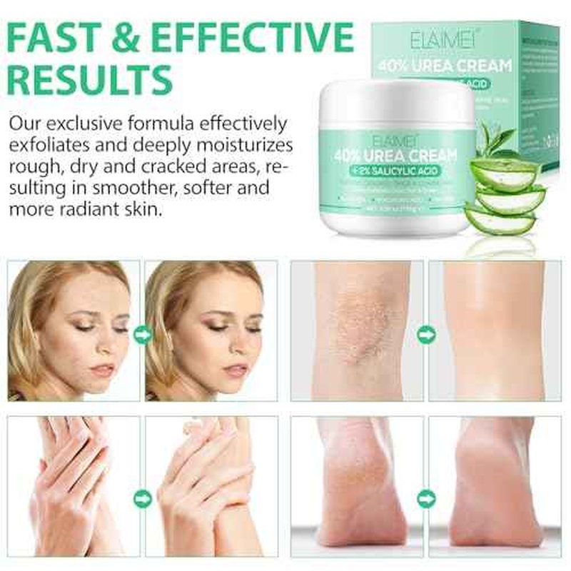 Urea Cream 40 Percent for Feet - 40% Urea Cream Plus 2% Salicylic Acid with Hyaluronic Acid,Tea Tree, Aloe Vera for Dry Cracked Heels, Knees & Maximum Strength Foot Deep Moisturizer(5.29 OZ)