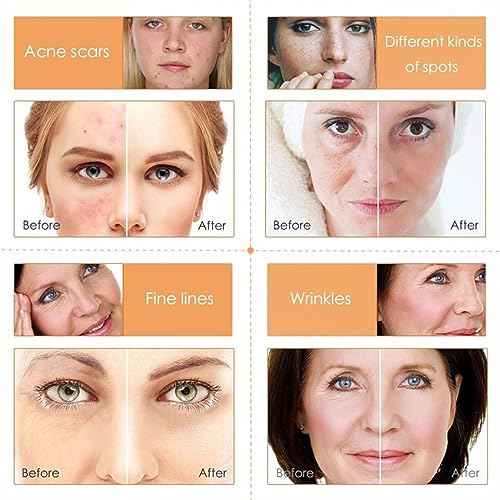 Vitamin C Skin Care Set, Girls Skincare Gift Set With Cleanser, Toner, Face Serum, Face & Eye Cream, Skin Care For Teens 10-12, Lasting Moisturizing Travel Skincare Set For Women