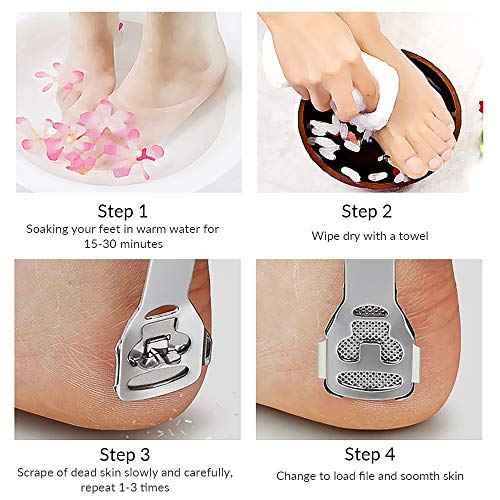 Codream Pedicure Callus Shaver Foot File Care Hard Skin Remover Callus Shaver Sets with Case, Foot File Heads & 10 Replacement Blade
