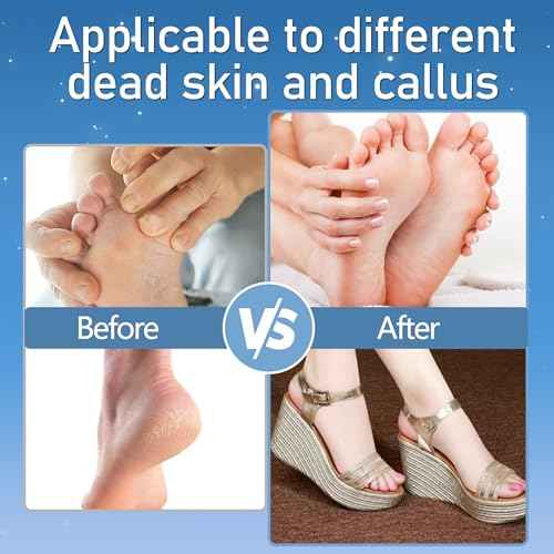 Callus Remover for Feet, Electric Foot Callus Remover Waterproof with 3 Rollers 2 Speed Battery Display,17 in1 Rechargeable Foot File Pedicure Kits for Dead Hard Cracked Dry Skin