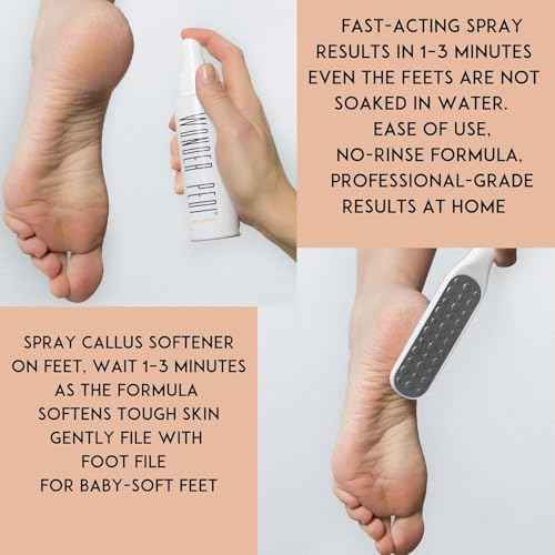 Callus Remover - Three Minutes Quick Fix- Foot File Rasp - Instant Foot Exfoliating Softener Peel Spray, Heels Callus Scrubber File - Home Spa Pedicure Treatment. Wonder Pedi