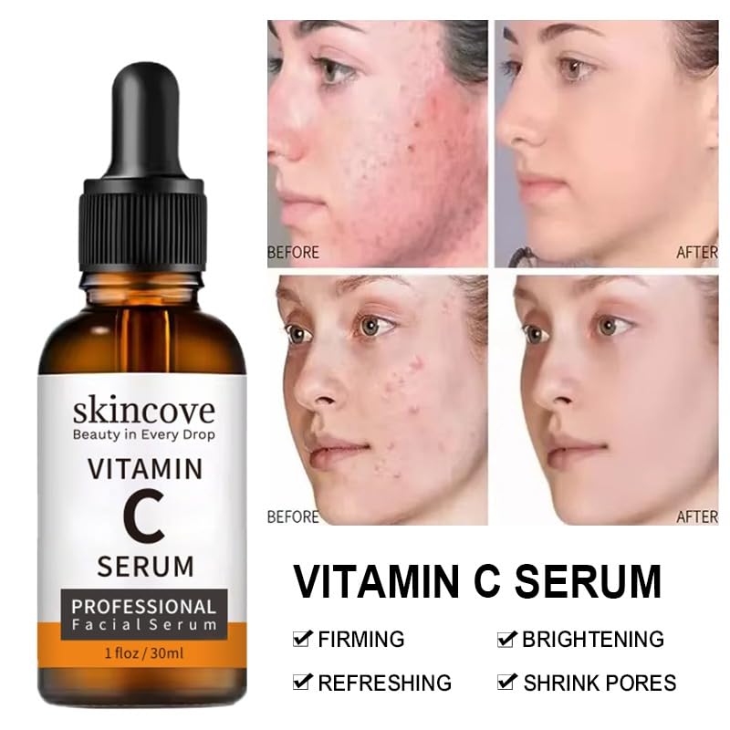 Skincove Vitamin C Serum - Anti-Aging Facial Serum with Hyaluronic Acid & Vitamin E | 1 Fl Oz for Even Skin Tone