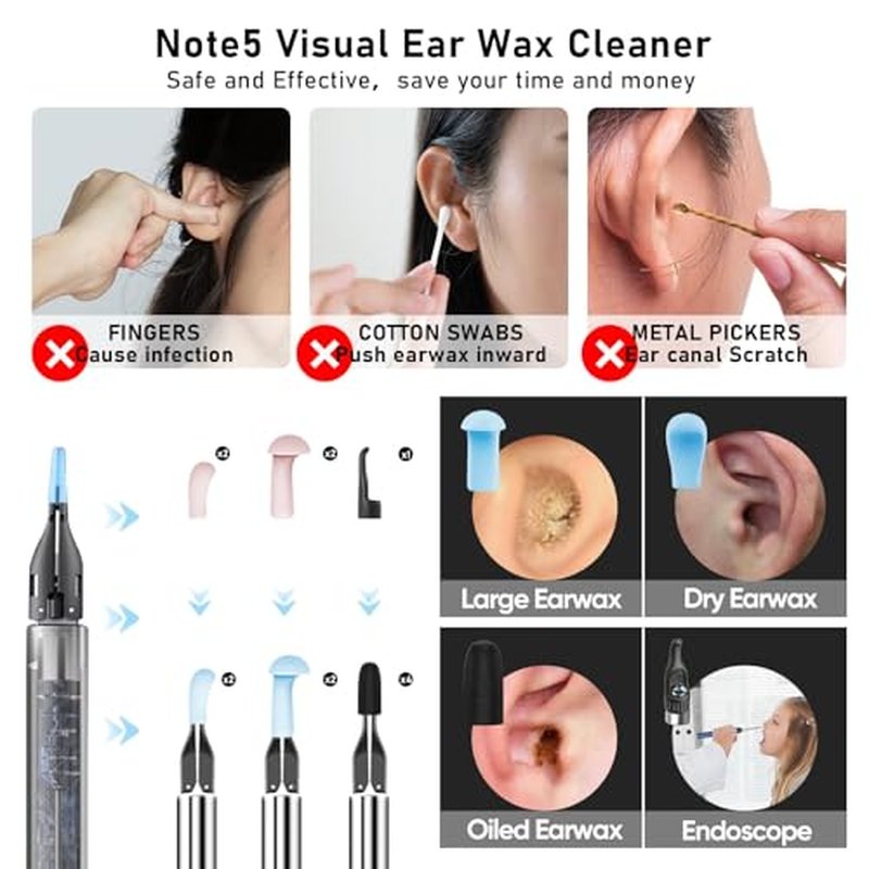 Note5 Ear Wax Tweezers with Camera, 10MP Ear Cleaner Camera Otoscope with Light,Real-time Remote Video with Ear Pick & Tweezers,12 Pcs Ear Scoops for Whole Family