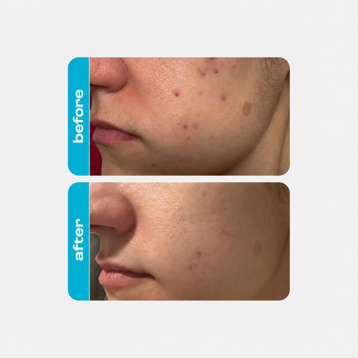 Creamy Skincare 10% Glycolic Moisturizer, Exfoliating Face Cream with Glycolic Acid, Niacinamide, and Hypskin, Nourishing, and Hydrating Cream, 1 fl oz/30mL