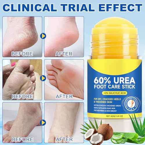 60% Urea Foot Cream Stick with 2% Salicylic Acid, Urea Foot Care Stick & Cream - Moisturizer for Dry, Cracked Skin on Feet, Knees, Elbows & Hands - Hydrates & Repairs Rough Skin 1Pack