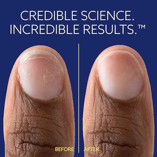 ePhD Bond Repair Nail Treatment, Nail Repair that Strengthens, Restores & Rebuilds Brittle Nails, Strengthens from Within, Formula for Damaged, or Post-Gel Nails, Use Alone or as a Polish Base