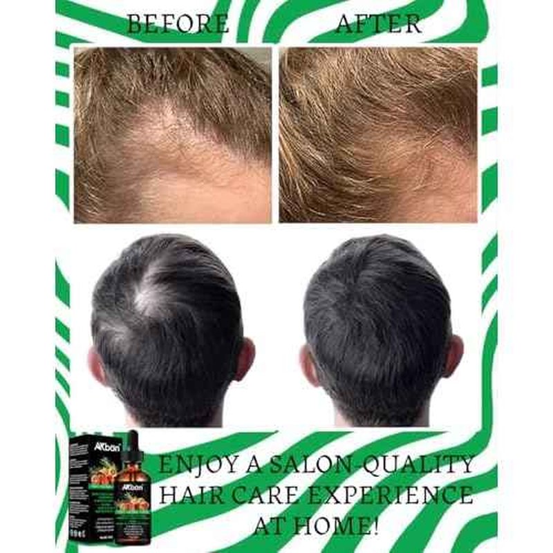 Batana Oil for Hair Growth, with Rosemary Oil Maca Argan Jojoba Oil, Promotes Hair Thickness, Nourish Scalp and Hair for All Hair Tapes | Glass Bottle with Dropper | 1fl oz + 1 fl oz