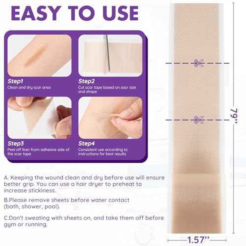 Silicone Scar Sheets, Silicone Scar Tape(1.6"x 79" Roll-2M), Reusable Professional Scar Silicone Strips, Soft Silicone Scar Sheets for Surgical Scars,Keloid,Acne Scars,Burn Scar,C-Section