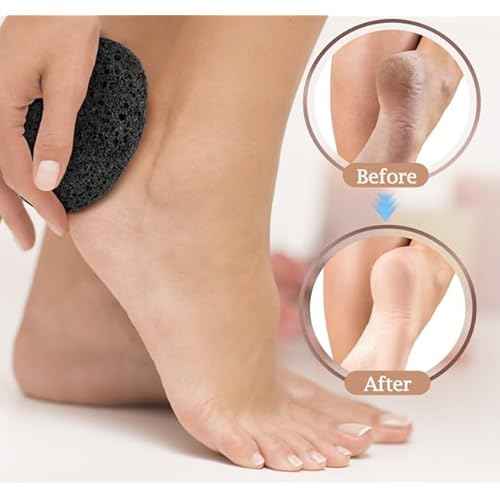 Pumice Stone Foot and Hand Scrubber - Natural Lava Stone for Callus Remover, Foot Exfoliation, Hand Scrub, Pedicure Tool, Dry Skin Remover, Promote Healthy Foot and Hand Care (Black)