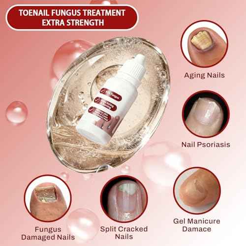 Toenail Treatment Extra Strength,Toenail Renewal Serum, Nail Conditioning Solution for Thick&Discolored Nails, Quick-Dry Dropper, Safely & Gently for Healthier Nails, 0.5 fl oz