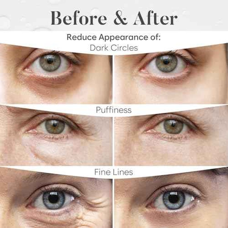 Variety Box Under Eye Patches for Puffy Eyes and Dark Circles(30 PAIRS), Collagen & Hyaluronic Acid Gel Masks for Hydration, Anti Wrinkle Patches, Bridesmaid Gifts, Bachelorette Party Favors