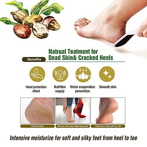 Epielle Hydrating Hand & Foot Masks 12 Pairs, Deep Moisturizing Socks & Gloves, Soften Dry Hands & Cracked Heels with Shea Butter & Jojoba Oil, Korean Skin Care, Foot Spa, Self Care Gifts for Women