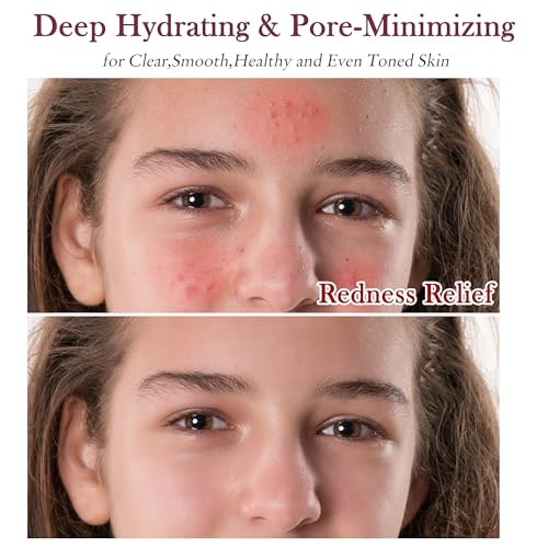 Skin Care Set,Women Girls Skin Care for Teens 10-12, Hydrate, Glow,Minimize Pore,Smooth,Travel Skincare,Birthday Teen Girl Gifts Trendy Stuff,Christmas Stocking Stuffers for Teens Teenage Tween Women