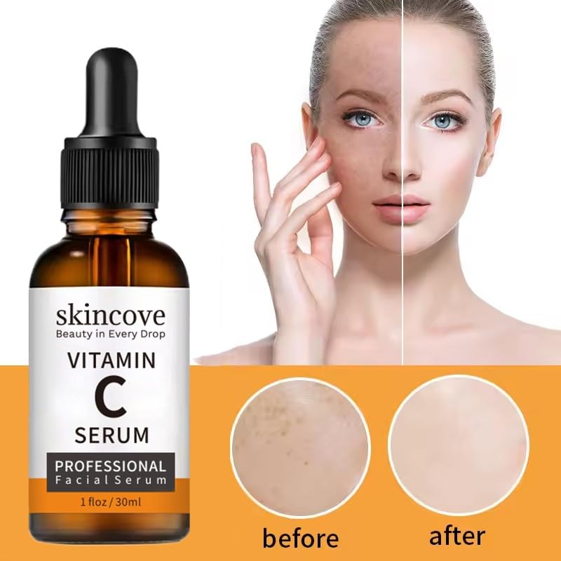 Skincove Vitamin C Serum - Anti-Aging Facial Serum with Hyaluronic Acid & Vitamin E | 1 Fl Oz for Even Skin Tone