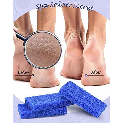 Maryton Disposable Foot Scrubber Pumice Pads, Pedicure Pumice Stone Dead Skin Callus Remover for Feet, 40Pcs (Dark Blue Coarse)