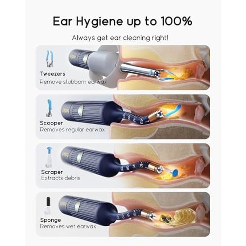 Earsight Plus I35R Ear Wax Removal Tool with Camera | Smart Visual Ear Cleaner with Gentle Tweezers & 12 Tips, HD Otoscope for Adults & Kids