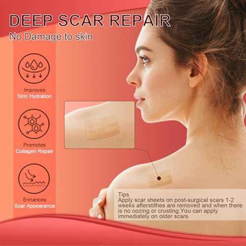 Silicone Scar Sheets (1.6¡±x 60¡± Roll-1.5M), Medical Grade Silicone Scar Tape Roll, Reusable Silicone Scar Strip, Professional Scar Removal Sheets for Surgery, C-Section, Burn, Keloid, Acne Etc