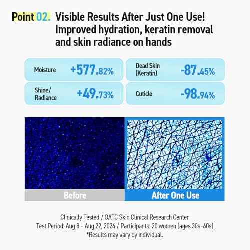 Milky Moisture Hand Mask ? Hydrating Gloves for Dry Hands | 5 or 10 Pairs (5 Pair (Pack of 1)) (5 Pair (Pack of 1))