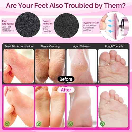 LIONVISON Electric Foot Callus Remover: Adjustable Speed Foot File for Cracked Heels - Working Women's Summer Pedicure Tool with 60pcs Sandpaper Discs - Dead Skin Remover for Dry Feet at-Home