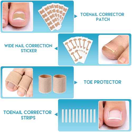 Ingrown Toenail Removal Kit, Professional Ingrown Toenail Tool Kit Includes Ingrown Toenail Corrector Drops, Corrector Patch, Toenail Clipper, Nail File Lifter Pedicure Tools