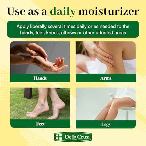 De La Cruz Arnica Salve - Foot Cream for Dry Cracked Heels and Feet - Moisturizing Hand Salve for Dried Hands - 24 Hour Moisture Foot Cream for Dry Cracked Feet and Rough Skin - JUMBO SIZE 5.5 OZ