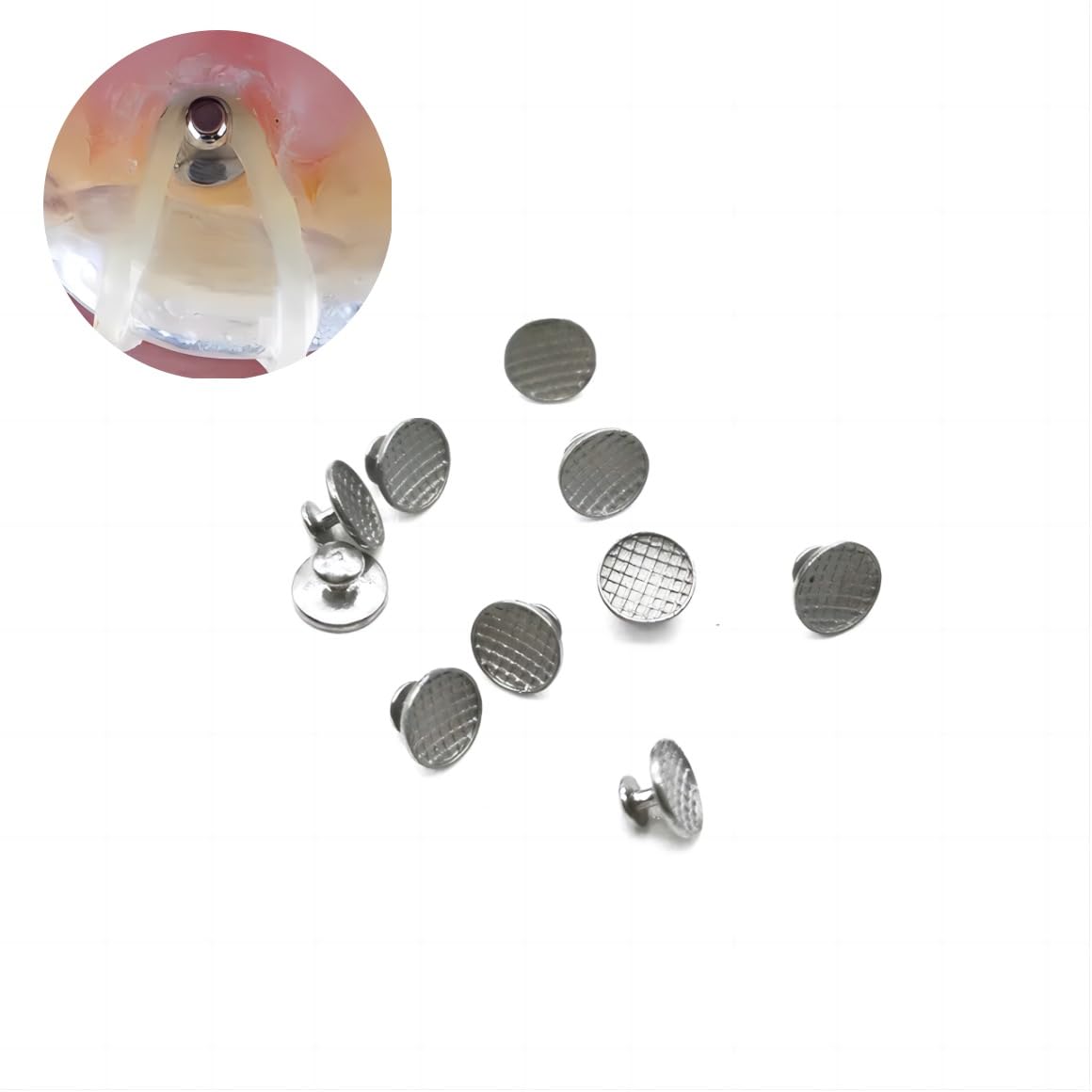 100Pcs Sino Dental Orthodontic Braces Lingual Buttons Bondable Round Mesh Base,10pcs/Pack