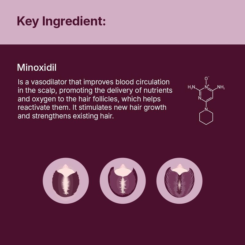 Santo Remedio Women’s Hair Regrowth Treatment, Helps Stimulate Hair Growth and Reduce Hair Loss, Contains 2% Minoxidil, Clinically Proven Ingredient, Fragrance Free (1-Month Supply)