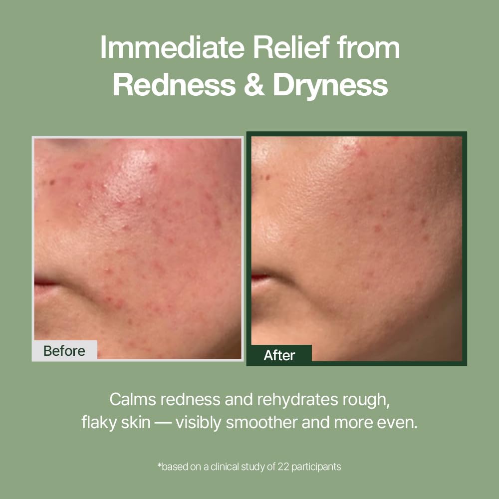 NATURAL DERMA PROJECT Green Caper Deep Hydration Cream (80ml / 2.70 Fl oz) Calming, Soothing, Panthenol, Hydrating for Sensitive and Dry Skin, Face Moisturizer, NDP