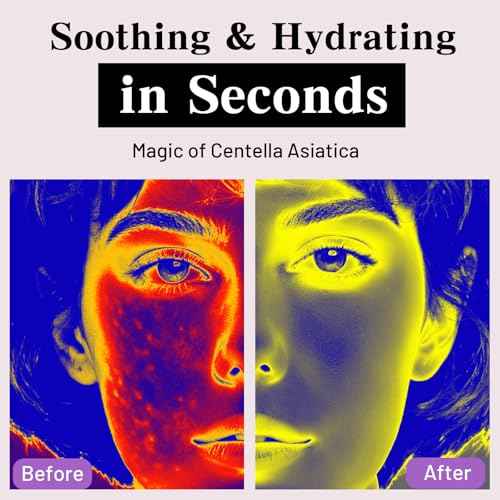 Collagen Face Mask Overnight, Acne Face Masks Sheet for Deep Hydrating and Glass Skin Glow, Jelly Gel Facial Mask for Women with Centella and Niacinamide, Oily Skin, 37gx4ea