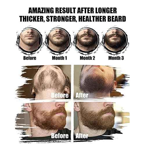 Beard Kit for Men Grooming & Care: with 2 Pack Beard Oils and Balm - Wash & Conditioner for After Shave Lotions Sandalwood, Brush and Comb Sets with Scissors, Valentines Fathers Gifts for Dad/Men/Him