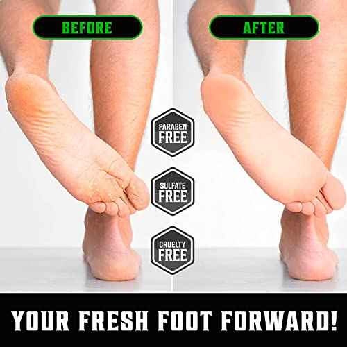 Viking Revolution Tea Tree Foot Cream for Dry Cracked Heels - Foot Balm For Cracked Feet - Dry Feet Repairing Cream with Aloe Vera and Mint (8oz)