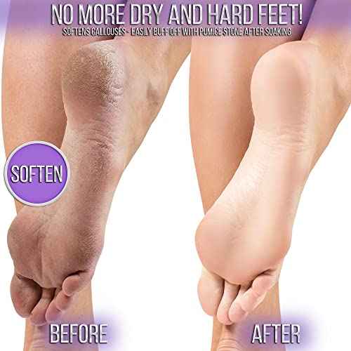 SOO Jelly Pedicure Packs - Pedicure Foot Soak For Feet - Moisturizing Jelly Spa Pedi Soak - Foot Spa Bath Soak For Soaking - Pedicure Foot Gel (Lavender)