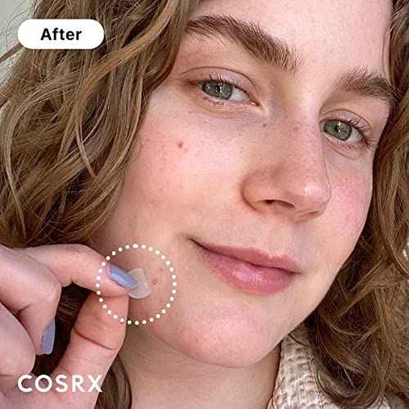 COSRX Acne Pimple Patch Absorbing Hydrocolloid Original 3 Size Patches for Blemishes and Zits Cover, Spot Stickers for Face and Body, Stocking Stuffers, Holiday Gifts, Gifts For Women