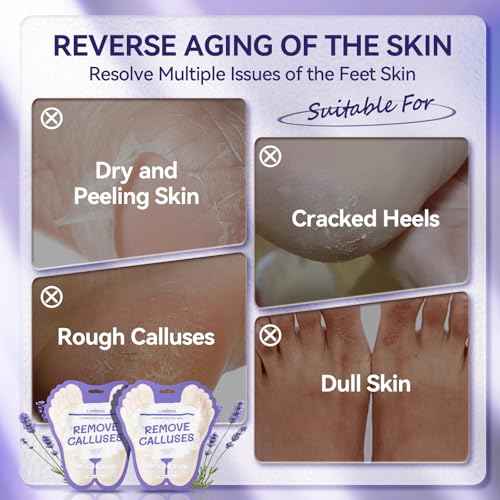 LANBENA Lavender Foot Peel Mask - Foot Peeling Mask for Removing Dry Dead Skin, Calluses & Repairing Rough Heels, for Baby Soft, Smooth Feet - (Lavender - 2 Pairs)