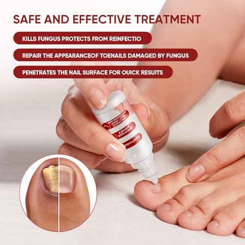 Toenail Treatment,Gentle Formula, Effectively Improves Nails for a More Beautiful Appearance