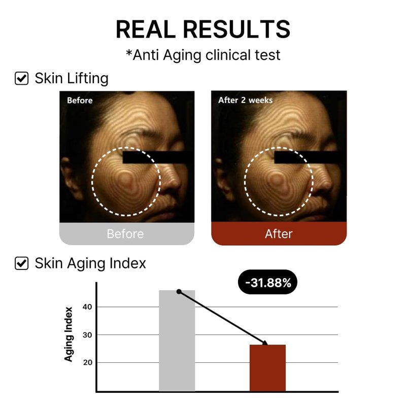 Mito-on Cell Rejuvenation Anti-Aging Serum, 50ml / 1.69 fl.oz –10% Niacinamide, Vitamin B3 and Antioxidants, Centella + EGF for Anti-Aging, Wrinkle Reduction, Pore minimization, Korean Skin Care